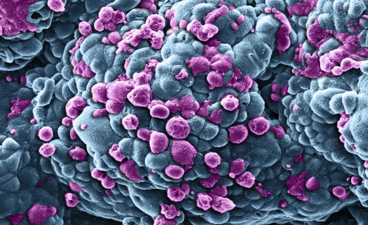 Rakovina je houba, a je léčitelná. Přepíše tento objev dějiny?